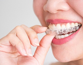 Closeup of patient putting on clear aligners
