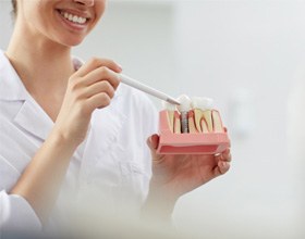 Dental professional explaining traditional implants vs All-on-4 in Chesterfield 