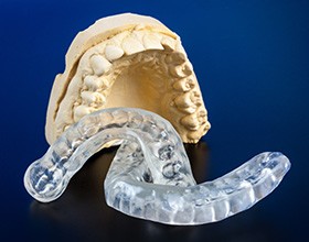 A mouth mold and two nightguards