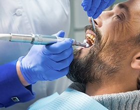 Man receiving dental bridge treatment