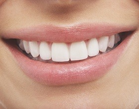 Closeup of flawless smile after dental bonding