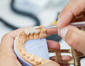 A dental technician working on dental crowns