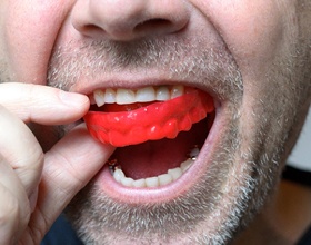 Closeup of man taking out a red mouthguard from upper arch