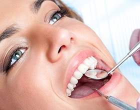 Closeup of patient during preventive dentistry exam