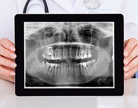 Digital x-rays on tablet computer