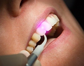 Patient receiving soft-tissue laser dentistry treatment