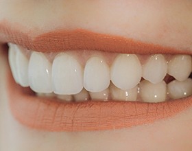 Woman smiling with veneers in Chesterfield