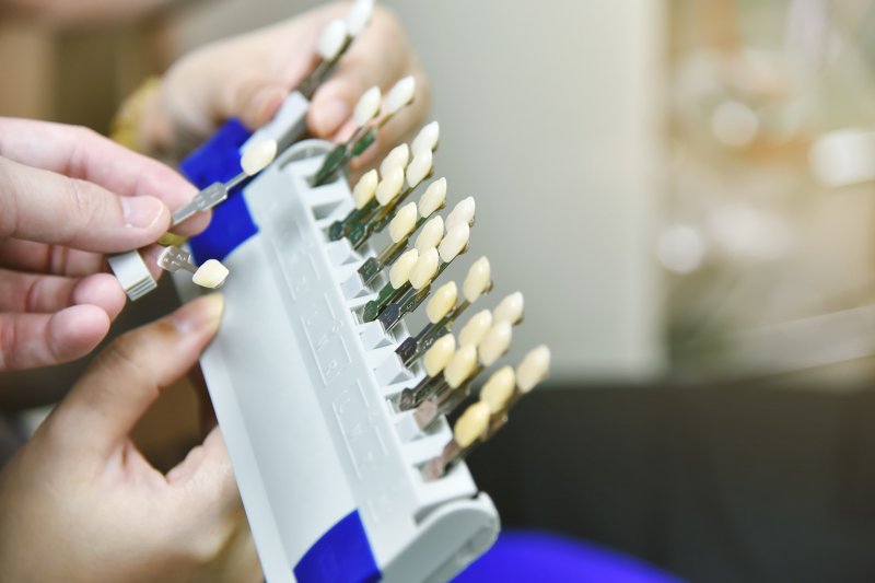 Dentist working with a tooth shade guide