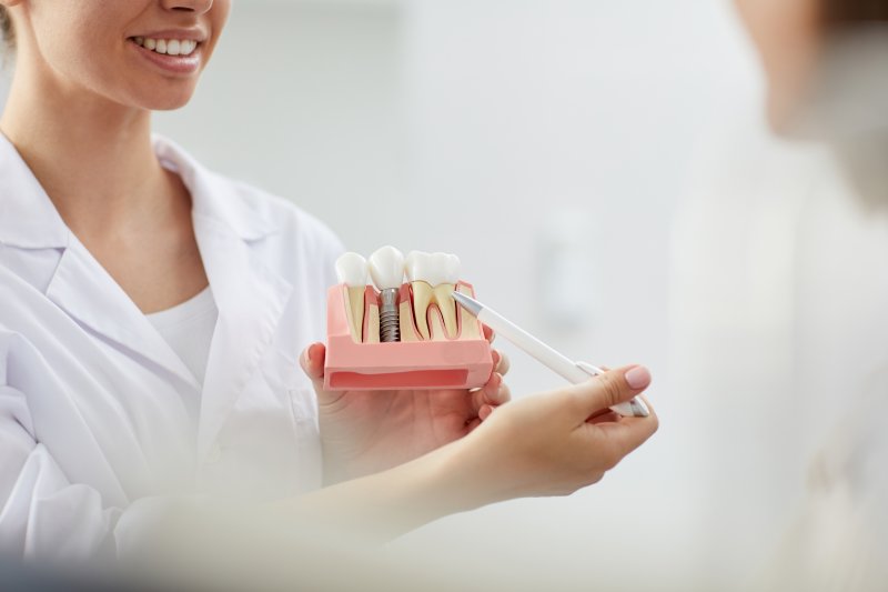 Dentist showing a patient a model of a dental implant