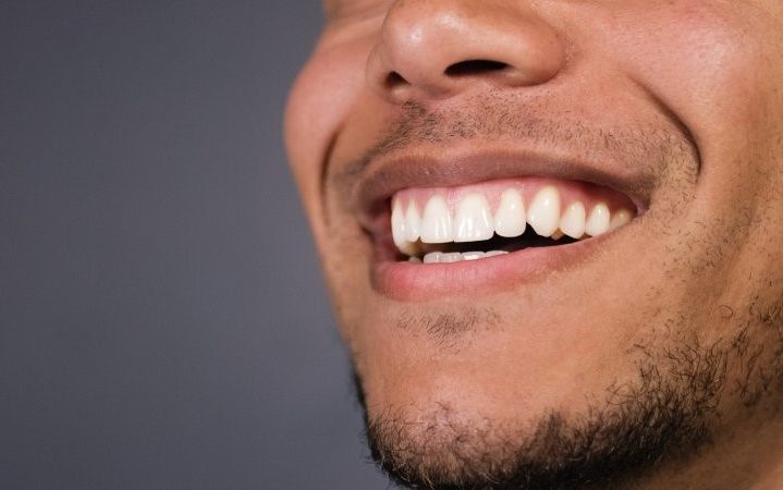 closeup of person who had cosmetic dental flaws fixed smiling