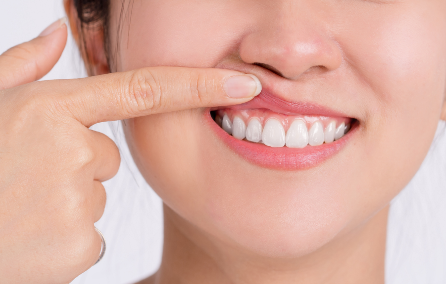 Woman showing gums